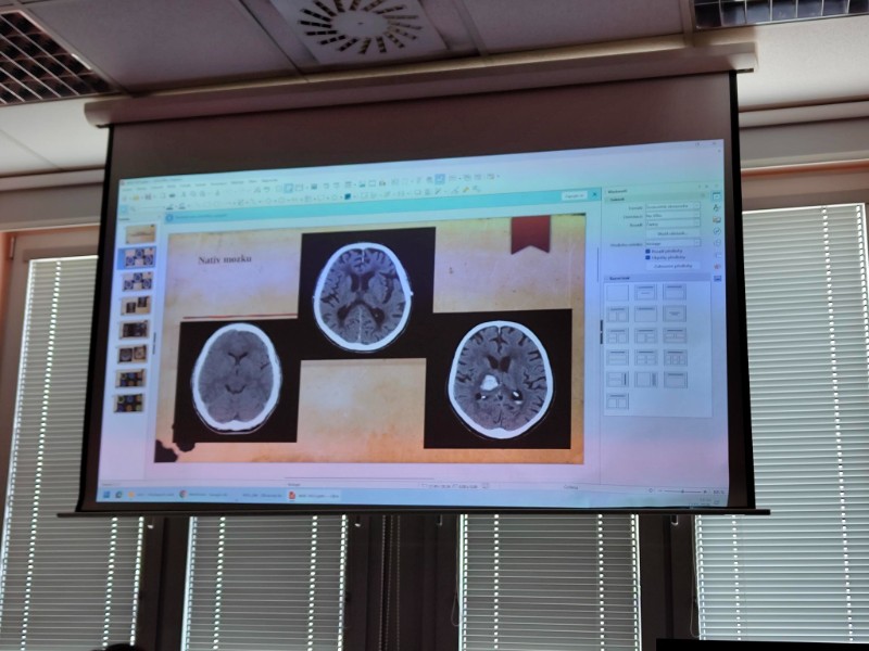 Návštěva iktového centra neurologického oddělení Litomyšlské nemocnice Návštěva iktového centra neurologického oddělení Litomyšlské nemocnice